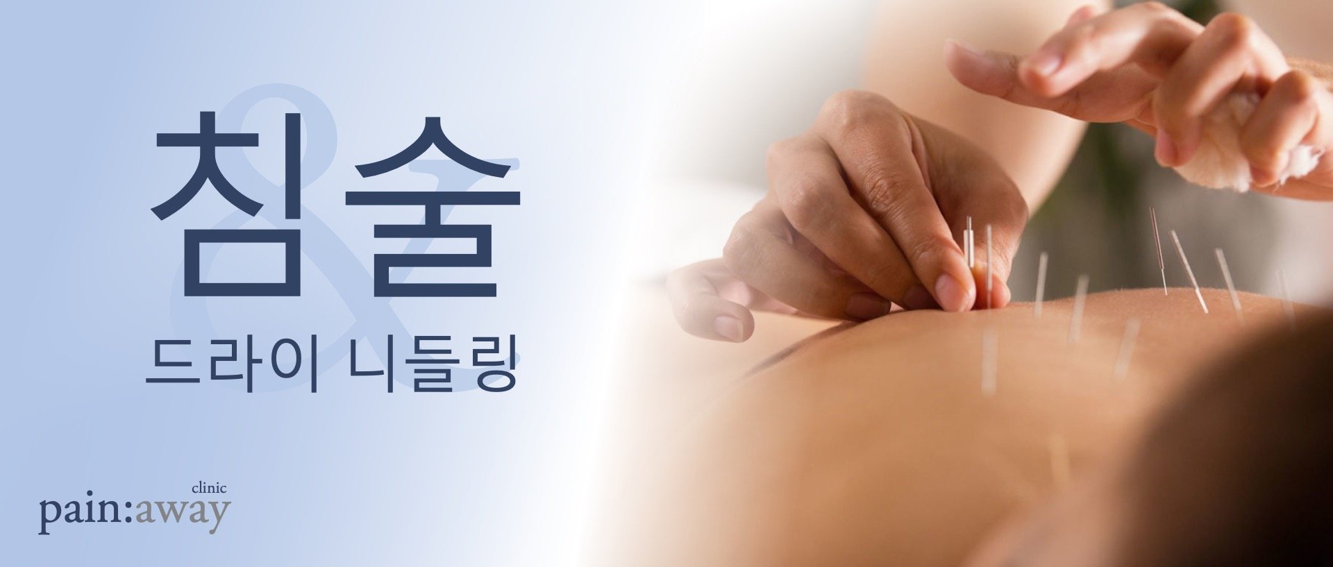 treatment_acupuncture_ko